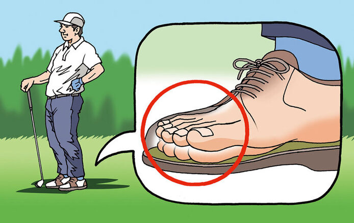 ゴルファーのための爪ケア【実践編】